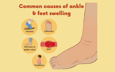 Common causes for Feet and Ankle Problems