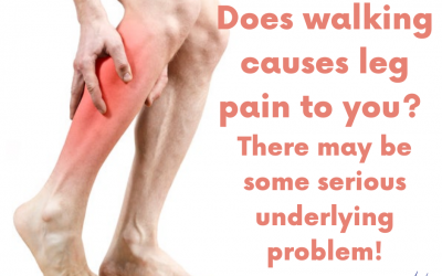 Does walking causes leg pain to you?