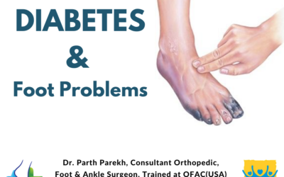 Diabetes and Foot Problems