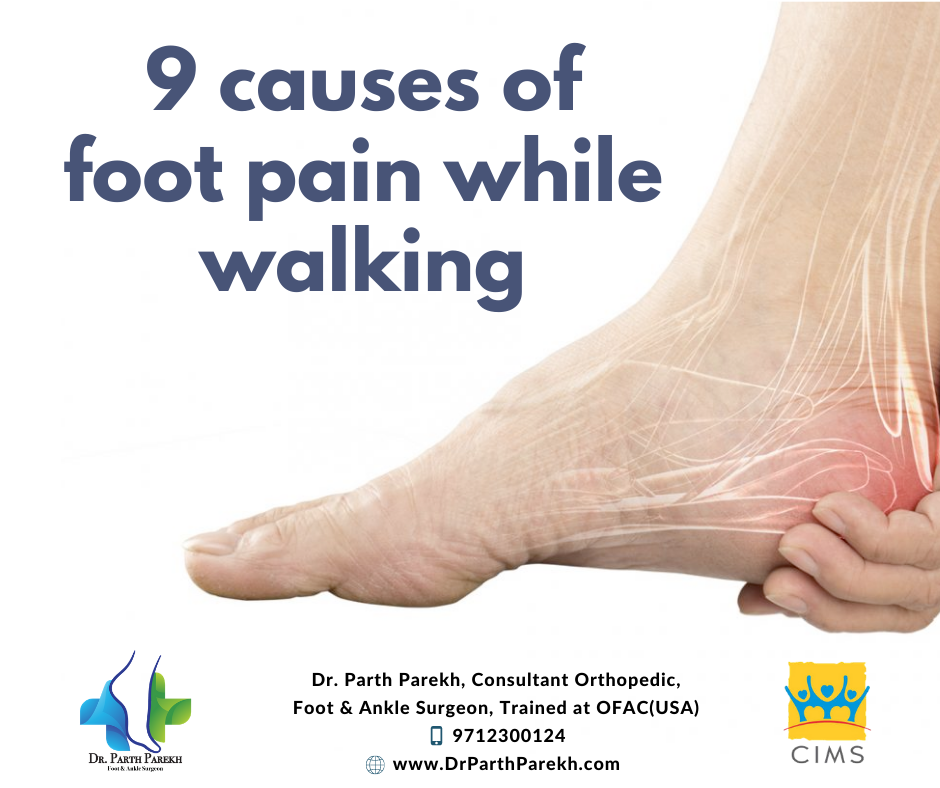 9 causes of foot pain while walking Dr. Parth Parekh
