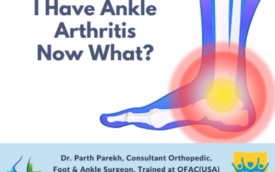 I Have Ankle Arthritis Now What?