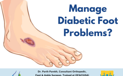 How to Manage Diabetic Foot Problems?